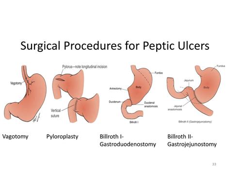 Ppt Chapter 34 Lee Resurreccion Assessment Of Digestive And