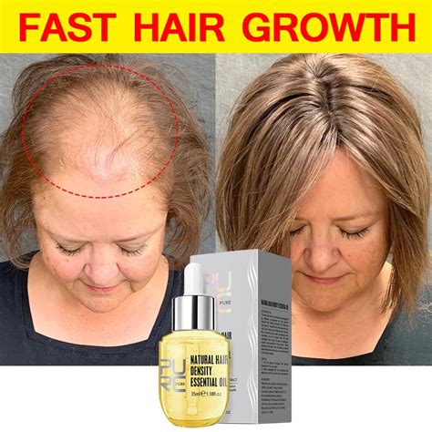 Purc Fast Hair Growth For Men Women Hair Oil Care Ginger Anti Hair Loss