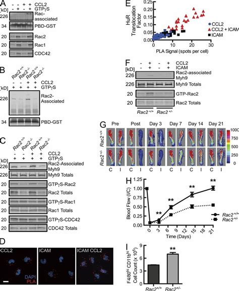 Chemokine Coupled Integrin Driven Activation Of Rac2 Leads To A Unique