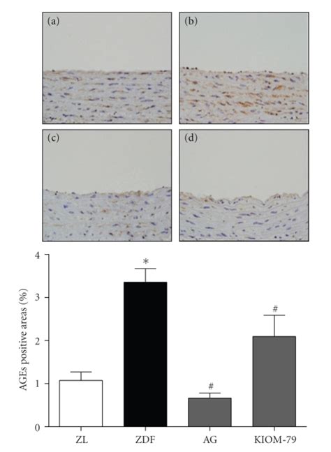 The Effects Of KIOM 79 Treatment On The Expression Of AGEs In The Aorta