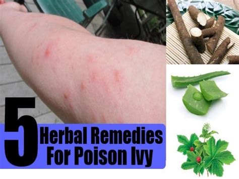 5 Herbal Remedies For Poison Ivy