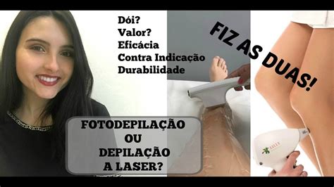 Fotodepilação ou depilação a laser Valores dor eficácia EU FIZ AS