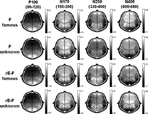 Voltage Scalp Maps Representing The Topography Of The Main Components