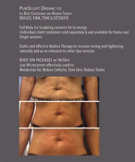 PureSculpt Ice Body Contouring Hieloterapia This Product Can Help