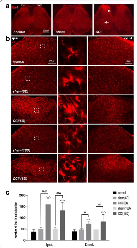 Numbers Of Iba Labeled Microgliacytes In Ipsilateral And