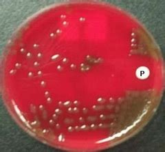 Bacitracin, Novobiocin, and Optochin Susceptibility Tests Flashcards | Quizlet