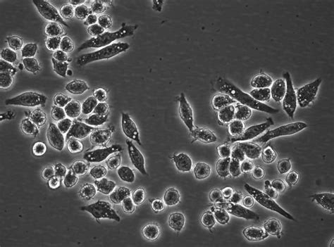 Cell Morphology Of J A Cells And Counting