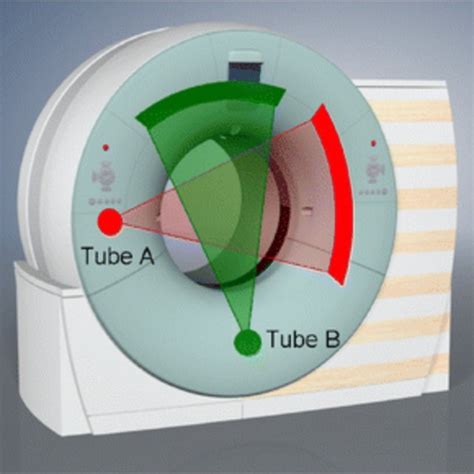 Dual Source Computed Tomography Dsct System With A Schematic Download Scientific Diagram