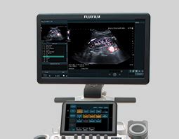 Surgical Planning Fujifilm Healthcare Americas Corporation