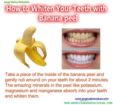 Use The Inside Of A Banana Peel As Tooth Whitening, The Potassium And Magnesium Whiten Them ...