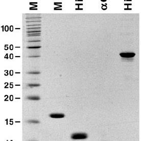 An SDS-polyacrylamide gel containing samples of the pu- | Download ...