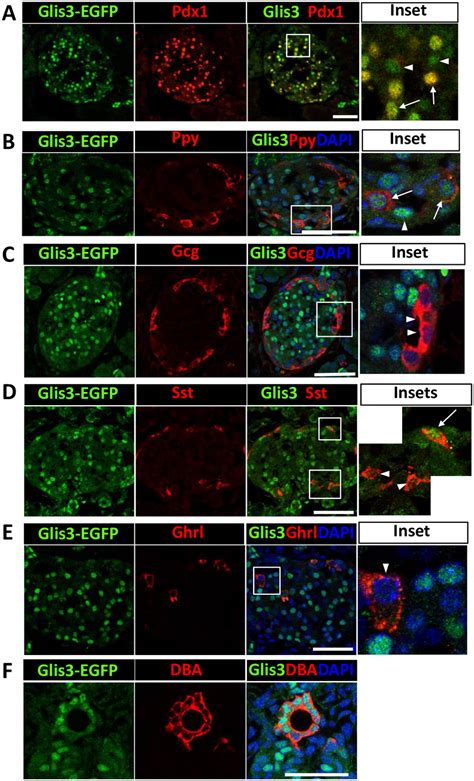 Glis Protein Is Selectively Expressed In Mouse Pancreatic Islets And