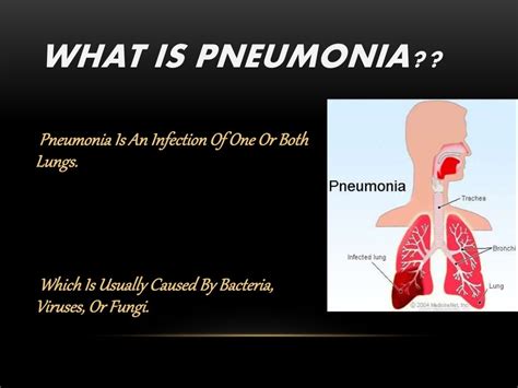 Fungal pneumonia