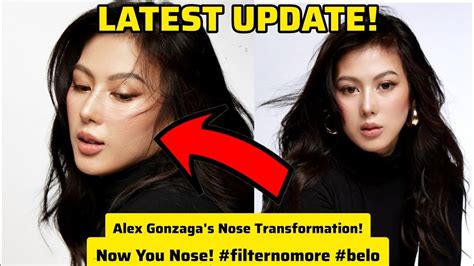 Alex Gonzaga S Nose Transformation LATEST UPDATE YouTube