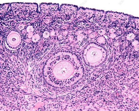 Ovary Histology Types Of Follicles Diagram Quizlet