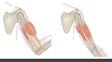 Spieren Arm Diagram Quizlet