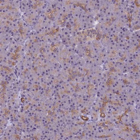 Rabbit Polyclonal Anti Vwa3a Antibody Buy For Research Highly