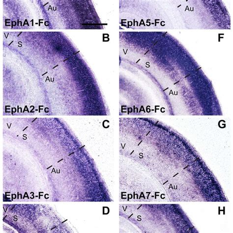 Distinct Expression Patterns Of EphA4 And EphA7 In Comparison To