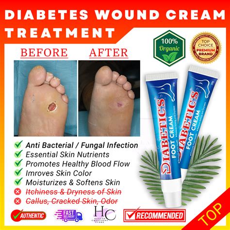 🦶 Cod Sumifun Diabetes Diabetic Foot Treatment Cream Diabetes Wound