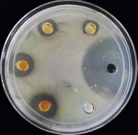 2 Inhibition Zone Diameter Of P Granatum L Ethyl Acetate Peel