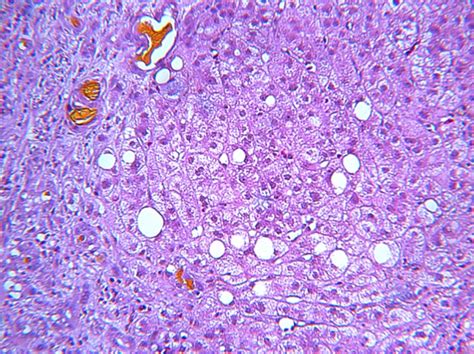 Bile Canaliculi Histology