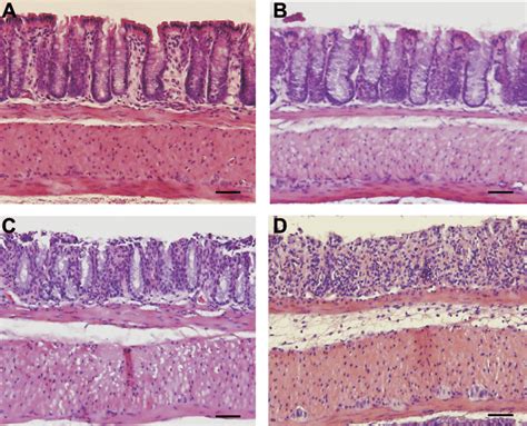 Dextran Sodium Sulfate Dss Mediated Tissue Histopathology Over Time