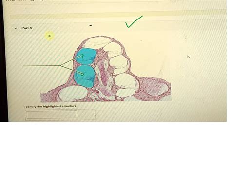 SOLVED Nervous System ANS And Special Senses Laboratory PALHistology