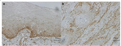 Immunostaining Showing Expression Of Lgr Examplary In Normal Oral