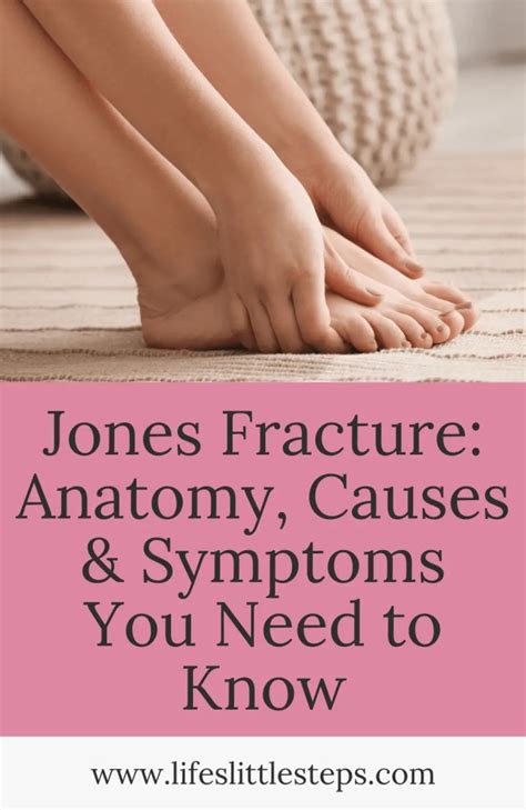 Jones Fracture: Anatomy, Causes & Symptoms You Need to Know