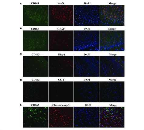 Triple Immunofluorescence Staining With Cd Neun A Iba B