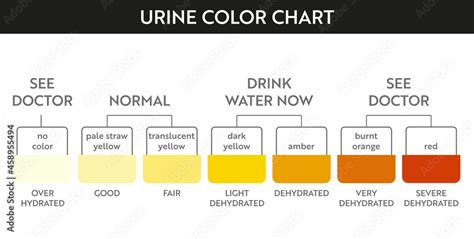 Urine Color Chart Amber Urine Color Chart For Dehydration Ehealthstar ...