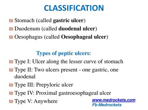 Gastric Ulcer Types