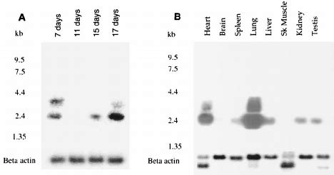 Tissue And Development Specific Expression Of Mesothelin Tran Scripts