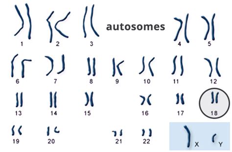 NIPT Cell Free DNA Quad Screen And More Heres What You Need To