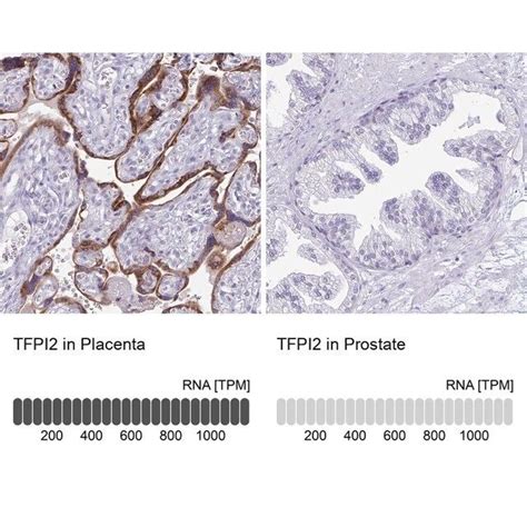 Anti Tfpi Antibody Produced In Rabbit