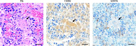 Low Sirpα Expression On Mgcs In The Spleen Of L Donovani Infected Download Scientific Diagram