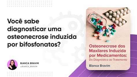 Voc Sabe Diagnosticar Uma Osteonecrose Induzida Por Bifosfonatos