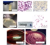 Answered Possible Unknown Strains Stapylococcus Bartleby