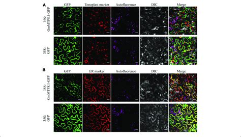 Subcellular Localization Of GmMTP8 1 In Tobacco Leaf Lower Epidermal