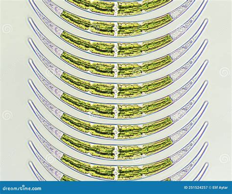 Closterium Sp. Charophyta Algae Under Microscopic View X40, Green Algae Stock Image - Image of ...