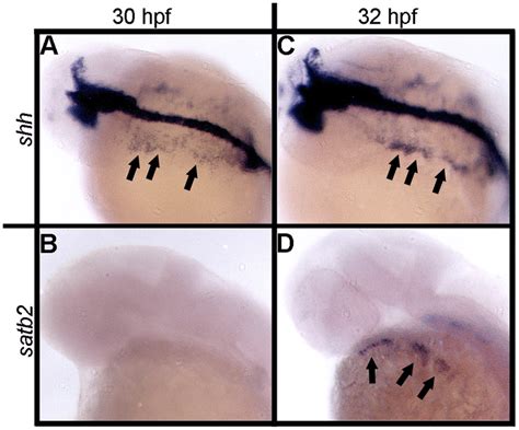 Expression Of Shh And Satb Correlate Spatially During Pharyngeal Arch