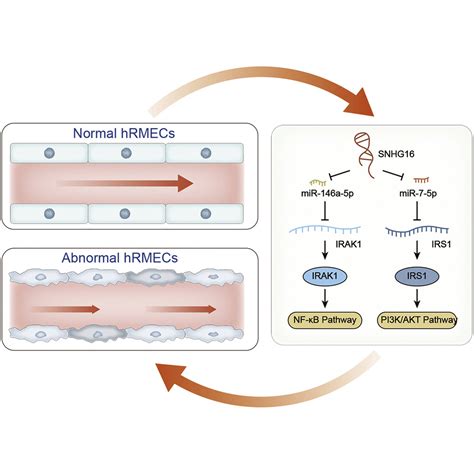 Upregulation Of Long Non Coding Rna Snhg16 Promotes Diabetes Related