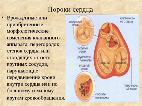 Пример из практики. Порок сердца - Здоровы с нами
