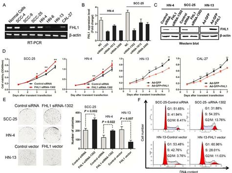 Effects Of FHL1 Knock Down Or Overexpression On Aggressive