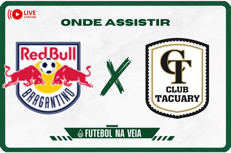 Rb Bragantino X Tacuary Ao Vivo E Online Onde Assistir Hor Rio E