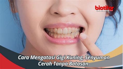 Cara Mengatasi Gigi Kuning Senyuman Cerah Tanpa Batasan Biotifor