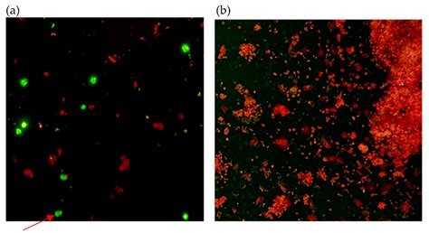Diagnostics Free Full Text In House Immunofluorescence Assay For