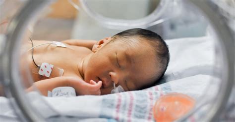 Ecmo For Babies Childrens Hospital Los Angeles