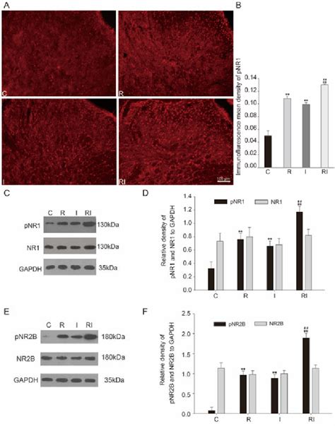 Figure 1 From Intraoperative Infusion Of Remifentanil Induces