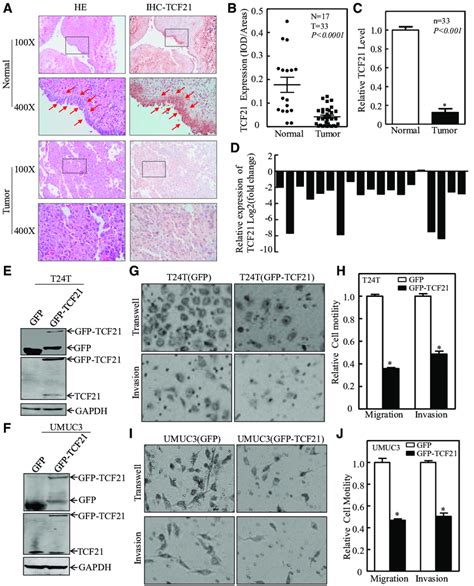 Tcf21 Is Downregulated In Bc Tissues And Ectopic Expression Of Tcf21